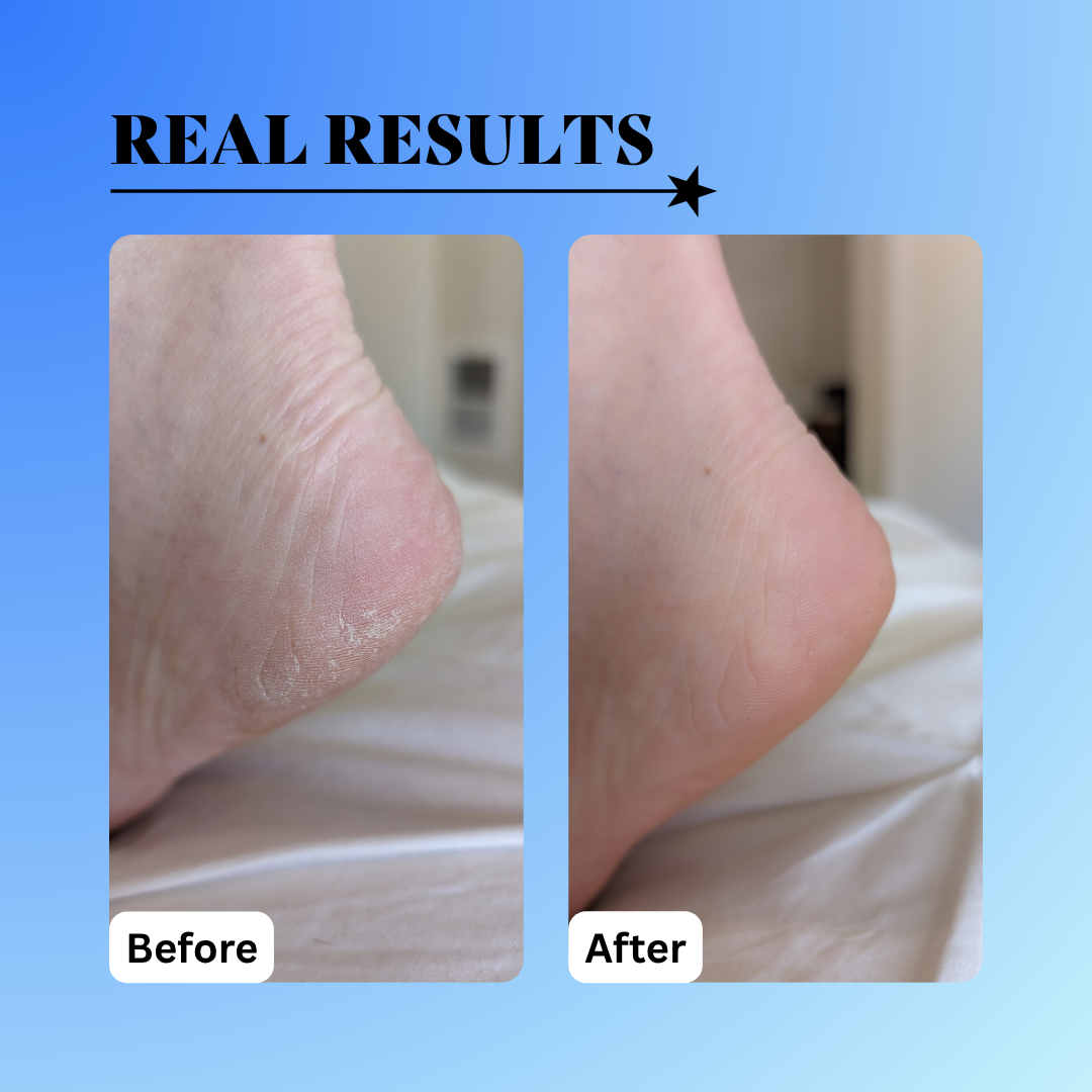 before and after dry skin using the 10% glycolic treatment tonic