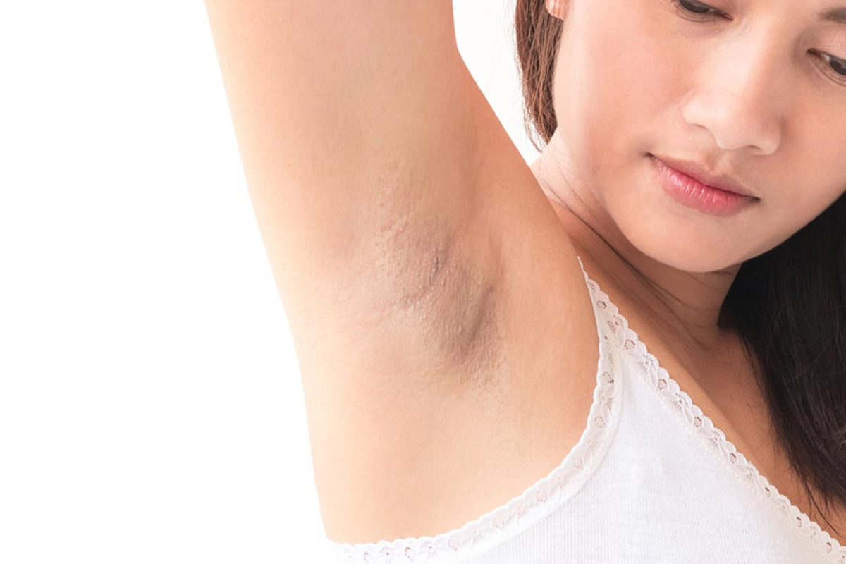 glycolic acid for body on armpit