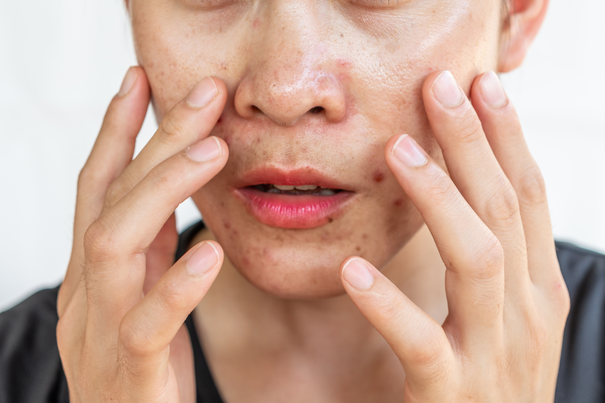 Woman touching her face while checking her skin