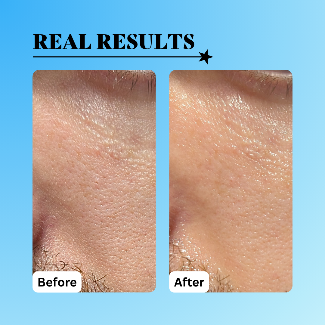 before and after hydration using the radical replenishment serum 