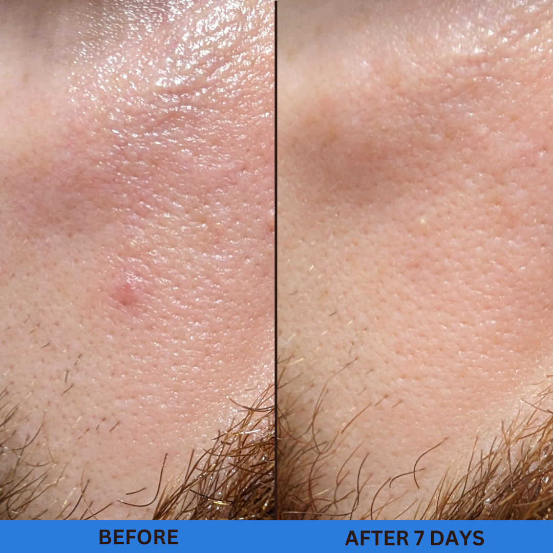 skin magic before and after 1