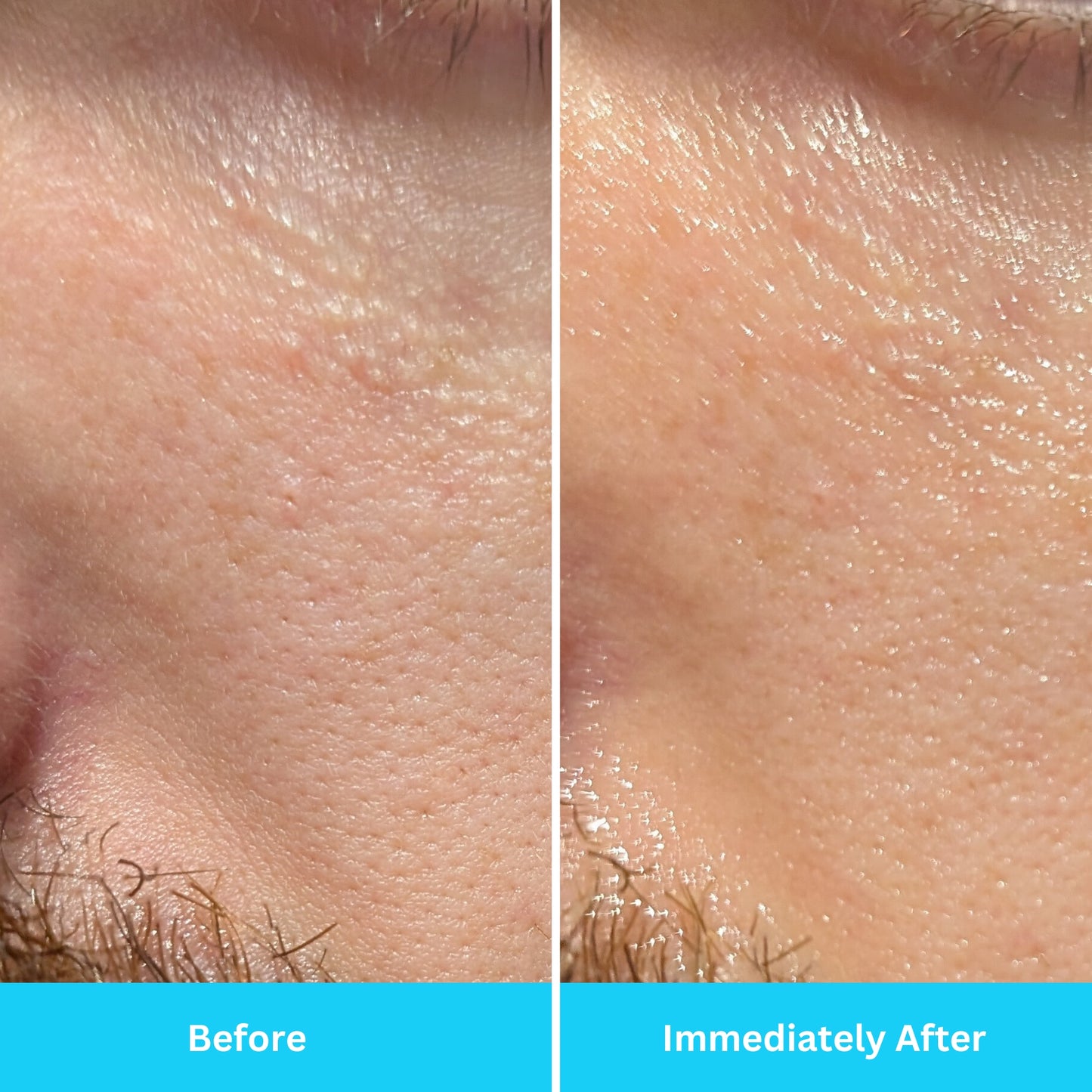 Before and after of the hydrating radical replenishment serum